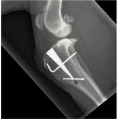X-ray of a dog knee after an MMP cruciate repair